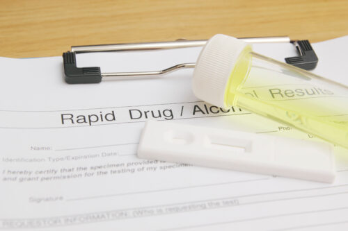 rapid drug test